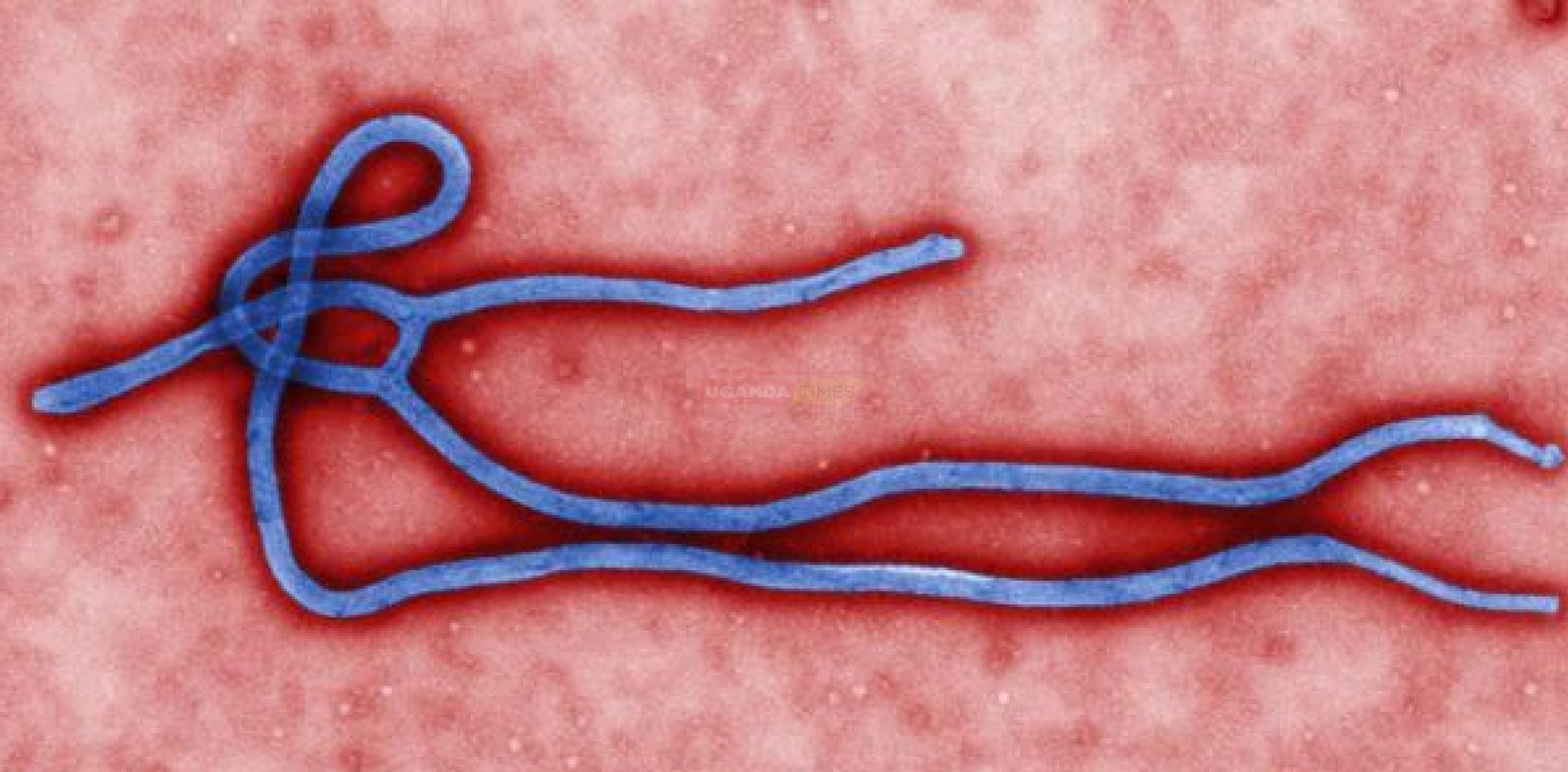 Suspected Cholera Outbreak Reported In Moroto